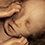 echographie-foetus